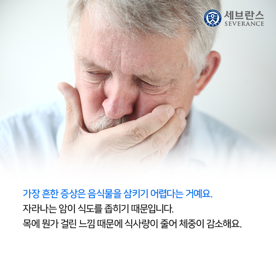 가장 흔한 증상은 음식물을 삼키기 어렵다는 거예요. 자라나는 암이 식도를 좁히기 때문입니다. 목에 뭔가 걸린 느낌 때문에 식사량이 줄어 체중이 감소해요. 