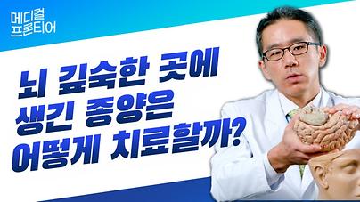 뇌 깊숙한 곳에 생긴 종양은 어떻게 치료할까?