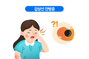 갑상선 안병증